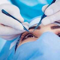 Laserova operacia oci je druh korekcie zraku, pri ktorej sa pomocou lasera pretvára rohovka oka, aby sa zlepšil zrak.